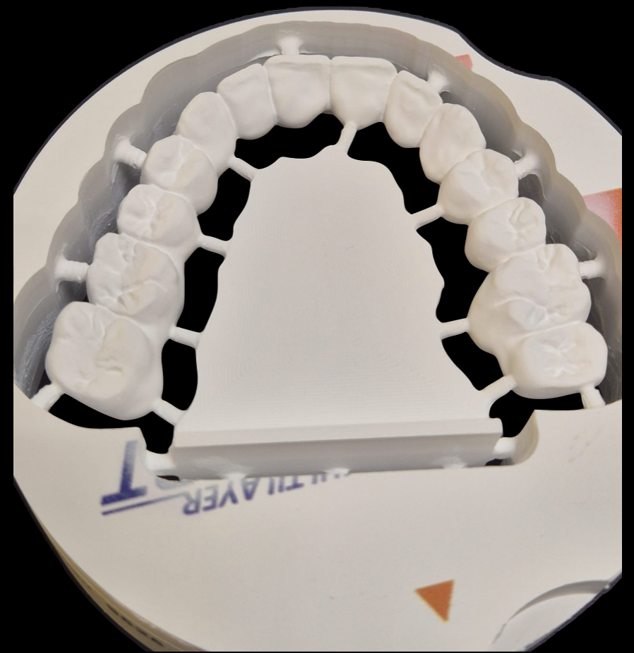 Corona de zirconio fabricada en BDL Biohealth Dental Lab